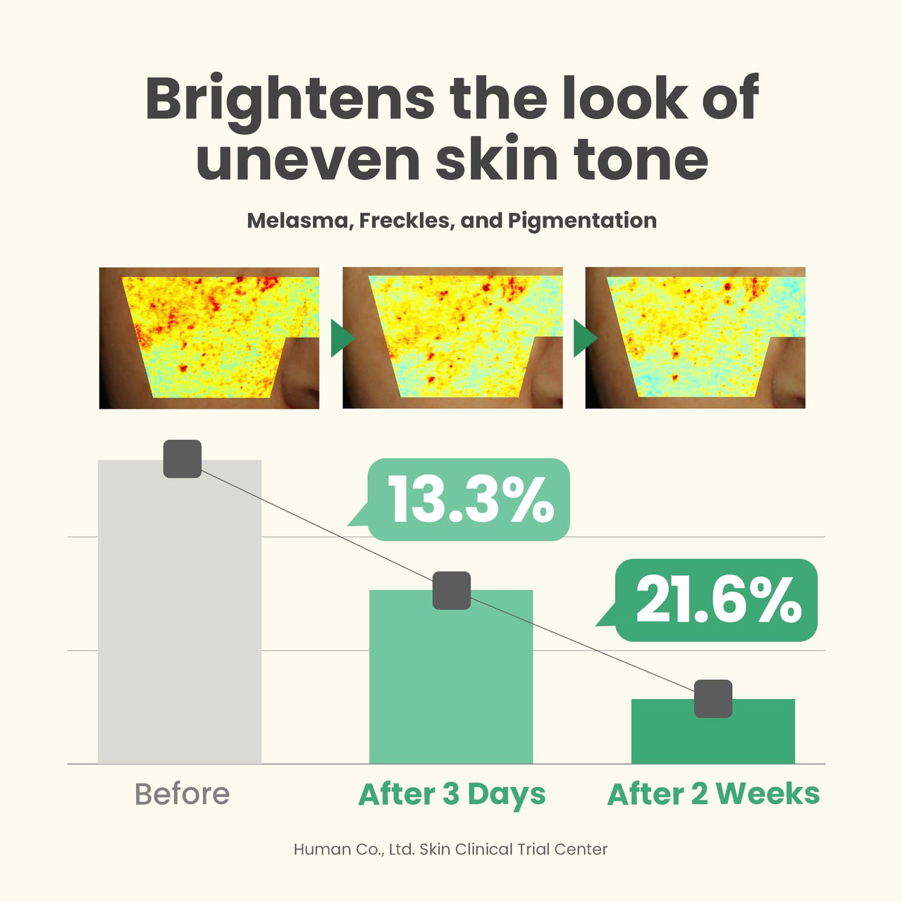 AXIS-Y Dark Spot Correcting Glow Serum 50ml / 1.69 fl. oz | Brightening Serum | Korean Skincare, Dark Spot Treatment, Hyperpigmentation Treatment (Pack of 1)