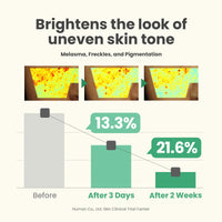 AXIS-Y Dark Spot Correcting Glow Serum 50ml / 1.69 fl. oz | Brightening Serum | Korean Skincare, Dark Spot Treatment, Hyperpigmentation Treatment (Pack of 1)