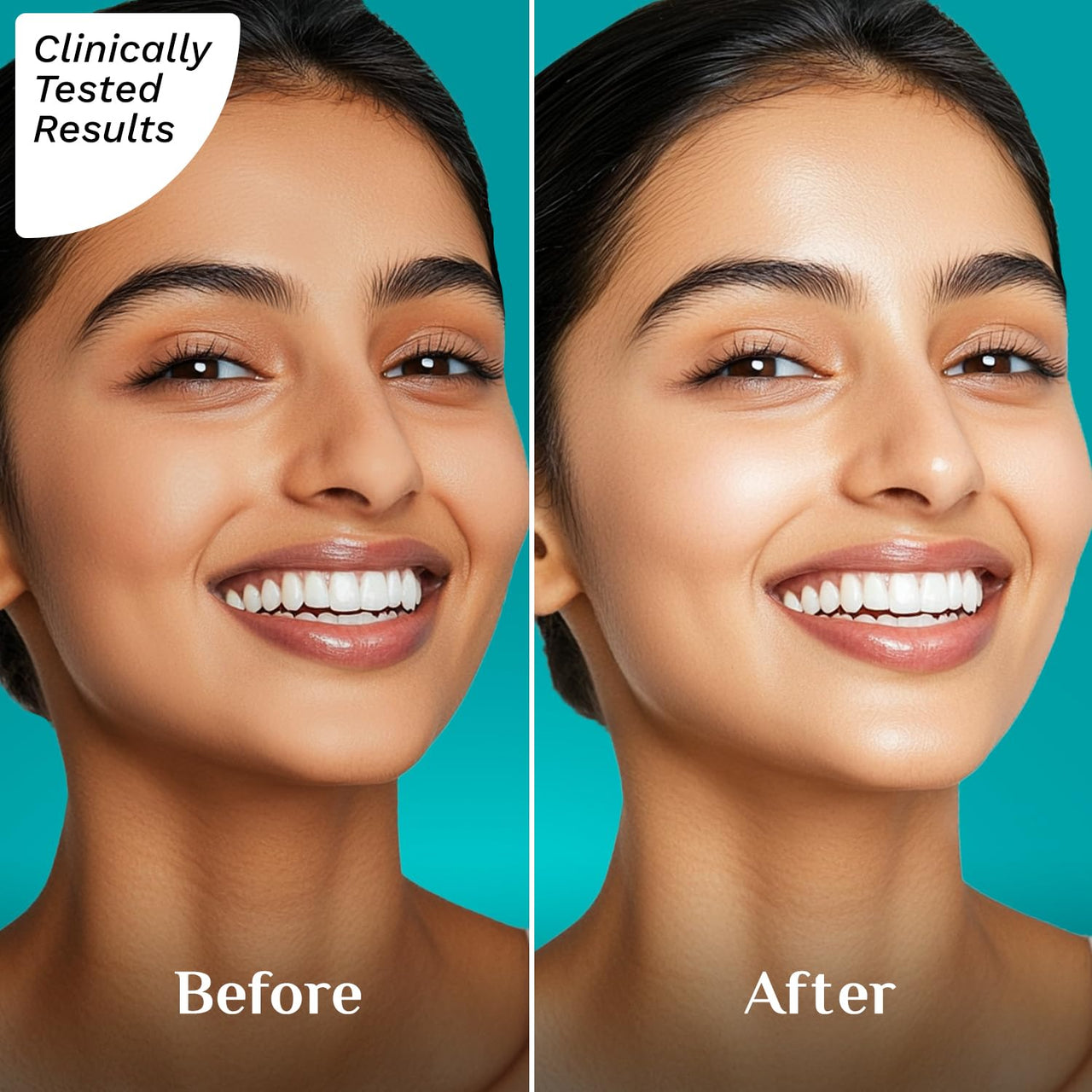 Pilgrim Squalane Niacinamide & Vitamin C Glow Moisturizer for face | Moisturizer for dry skin hydration | Face moisturizer with vitamin c for glowing skin | Non-greasy | For Women and Men I 50 gm