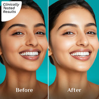 Pilgrim Squalane Niacinamide & Vitamin C Glow Moisturizer for face | Moisturizer for dry skin hydration | Face moisturizer with vitamin c for glowing skin | Non-greasy | For Women and Men I 50 gm