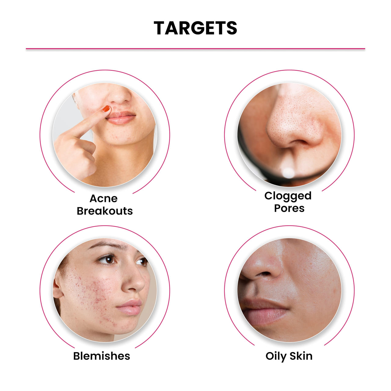 ThriveCo 2% Salicylic Acid Serum For Acne & Clogged Pores | Clears Dead Skin & Reduces Excess Sebum | For Men & Women | For Acne-Prone & Oily Skin | Non-Sticky, Vegan, Fragrance & Cruelty-Free | 30ml