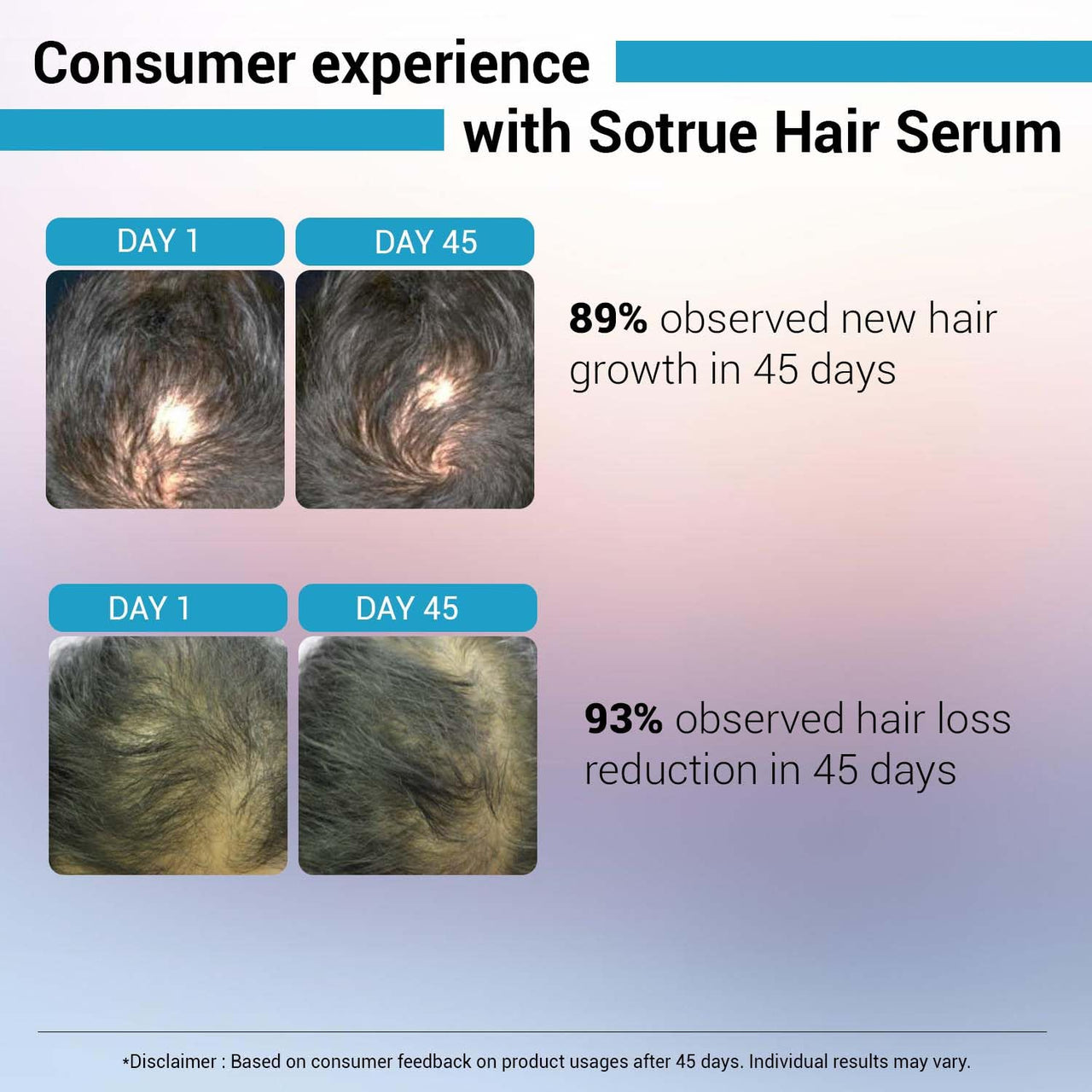 Sotrue Hair Growth Serum With 3% Redensyl - 2x Better Results than Minoxidil | 3% Procapil, 4% Anagain & 2% Baicapil | Hair Growth Actives, Hair Fall Control Serum For Women & Men, For All Hair Types, 30ml