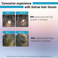 Sotrue Hair Growth Serum With 3% Redensyl - 2x Better Results than Minoxidil | 3% Procapil, 4% Anagain & 2% Baicapil | Hair Growth Actives, Hair Fall Control Serum For Women & Men, For All Hair Types, 30ml