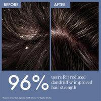 ThriveCo Anti Dandruff Scalp Clear Shampoo | Removes Dandruff From Source | Helps With flaky, Itching, Irritation & Redness Accompanying Dandruff | 100% Effective with First Use | With clinically proven Zenscalpin™, Octopirox, Salicylic Acid Formulation |