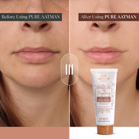 Pure Aatman Effective De-Tan Face Pack with Rice Water & Tomato Extract | Removes Tan, Blemishes & Blackheads in every use | Skin Renewal, Deep Cleansing Nourishment