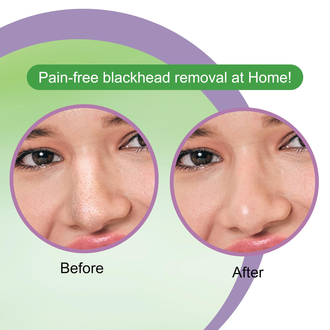 Tea Tree Nose Strips (Pack of 20) - 10 Pore Strips + 10 Wipes for Deep Cleansing & Blackhead Removal | Refreshing & Natural Tea Tree Oil Formula for Clearer Skin