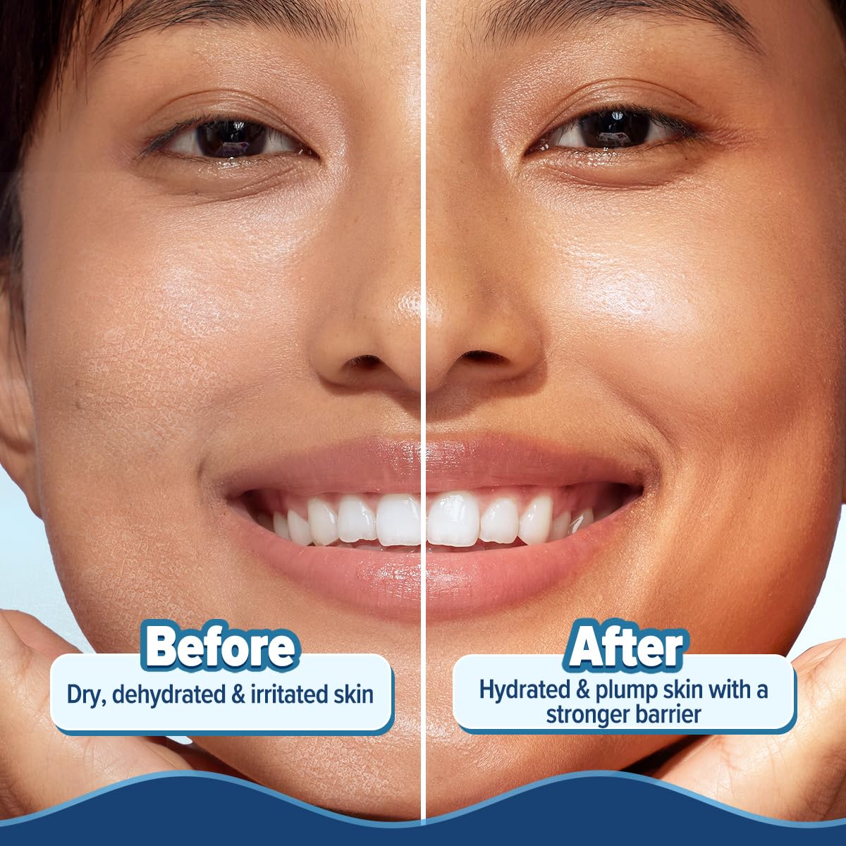 Aqualogica Barrier+ Hydra Gel Moisturizer with 5 Ceramides & Avocado | 24-Hour Intense Hydration | Weightless Water-Like Gel Texture | Non Sticky & Quick Absorbing for Healthy Skin Barrier | 200 g