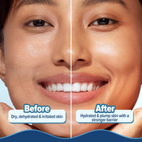 Aqualogica Barrier+ Hydra Gel Moisturizer with 5 Ceramides & Avocado | 24-Hour Intense Hydration | Weightless Water-Like Gel Texture | Non Sticky & Quick Absorbing for Healthy Skin Barrier | 200 g