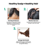 ThriveCo AHA BHA PHA Exfoliating Scalp Scrub | Promotes Hair Growth, Clears Dandruff, Dead Skin, Oil & Product Buildup | Works on Dry, Flaky & Itchy Scalp | For Men & Women | Travel-Friendly | 25ml