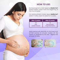 Mederma Stretch Marks Therapy | Stretch Mark Cream For Women & Men | Anti stretch mark cream during & After pregnancy (25g)