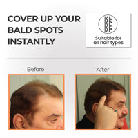 STYLEMAKE Thickener Hair Loss Concealer - Hair Building Fibers 28Gm - Hair Fibers For Thin & Fine Hair - Hair Thickening Fibers For Men & Women (Dark Brown), 28 Grams