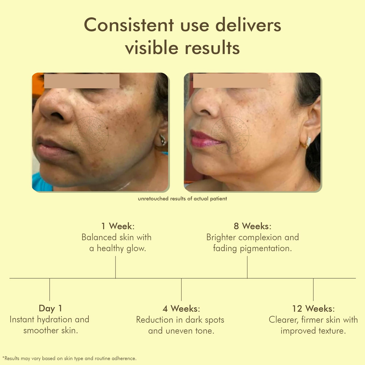 VEDICDERM Kumkumadi De-Pigmentation Night Cream 50g | Goodness of Saffron & Ceramides | Reduces Pigmentation, Dark Spots & Melasma | Evens Skin Tone & Enhances Radiance | Sulfate & Paraben Free