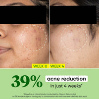 Dot & Key CICA Calming Skin Renewing Night Gel | For Oily, Acne Prone And Sensitive Skin | Night Cream with Niacinamide, Green Tea & Hyaluronic | Fades Blemishes & Dark Spots | 60ml