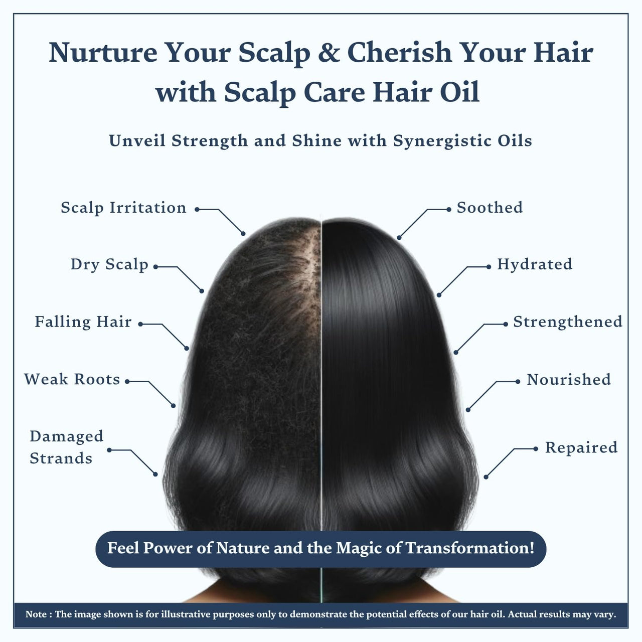 Singular Scalp Care Hair Oil for Itchy Scalp, Soothing & Sebum Control, Cold-Pressed with Tea Tree, Neem, Argan & More - 100 ml