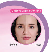 Dr.Rashel White skin Face Moisturizer 125 ml, Daily Lightweight Non-Oily Cream with Glycerin for Soft Glowing Skin, With Arbutin & Niacinamide