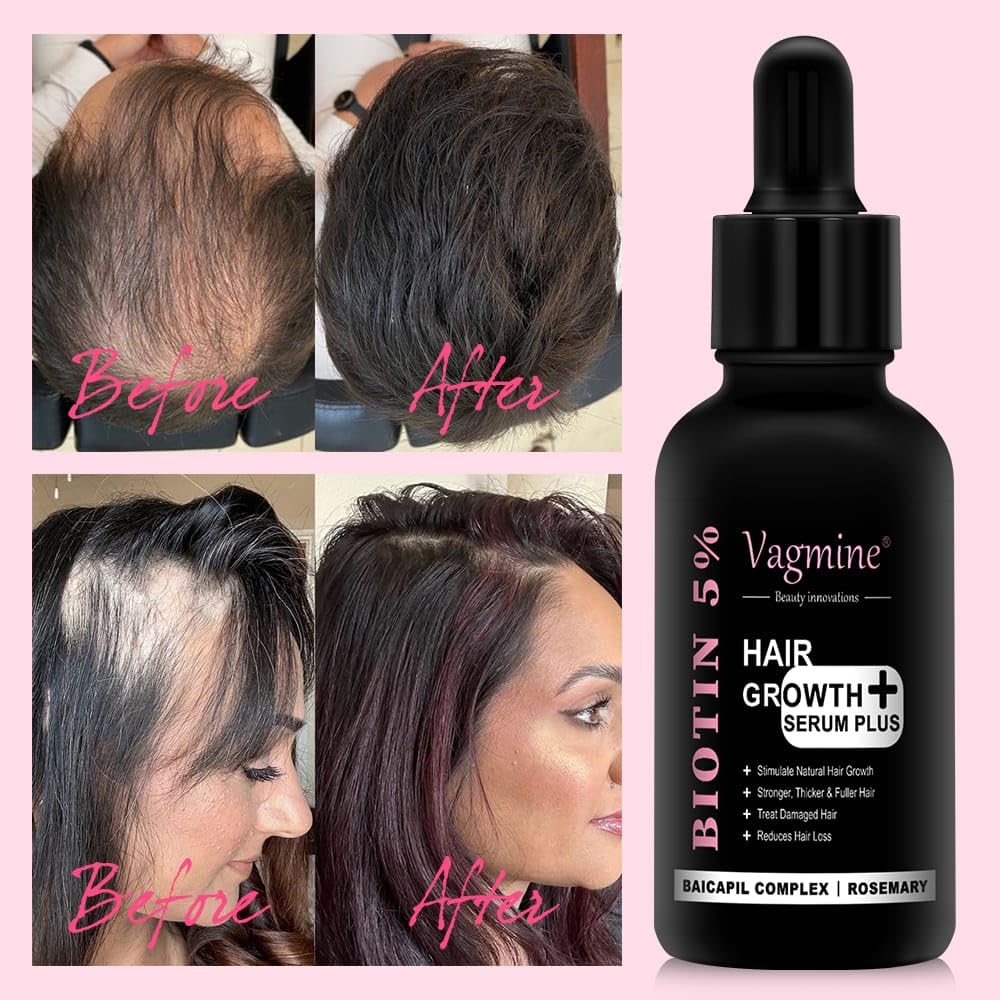 Vagmine Hair Growth Serum Plus With Biotin 5% & Rosemary - 60ml | Natural Treatment for Stronger, Thicker Hair | Promotes Healthy Hair Growth | Nourishes Scalp & Helps in Reduces Hair Fall
