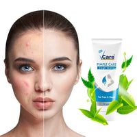 VCare Pimple Care Gel with Pimple Care Face Wash - 30g - 50g combo pack of 1