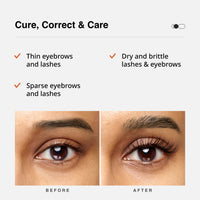 Cureskin Eye Brow & Lash Oil | Nourishes and Strengthens (7 ml) | Eyelash Growth Serum | Lash Serum for Eyelash Growth
