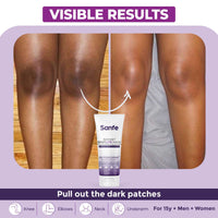 Sanfe Instant Spotlite Mask For Dark Underrams, Neck & Body| Dark Patch Removal Wipe-Off Cream in 10 Minutes | For Detanning, Anti Aging & Skin Tightening | Glycolic & Kojic acid with Charcoal 100g