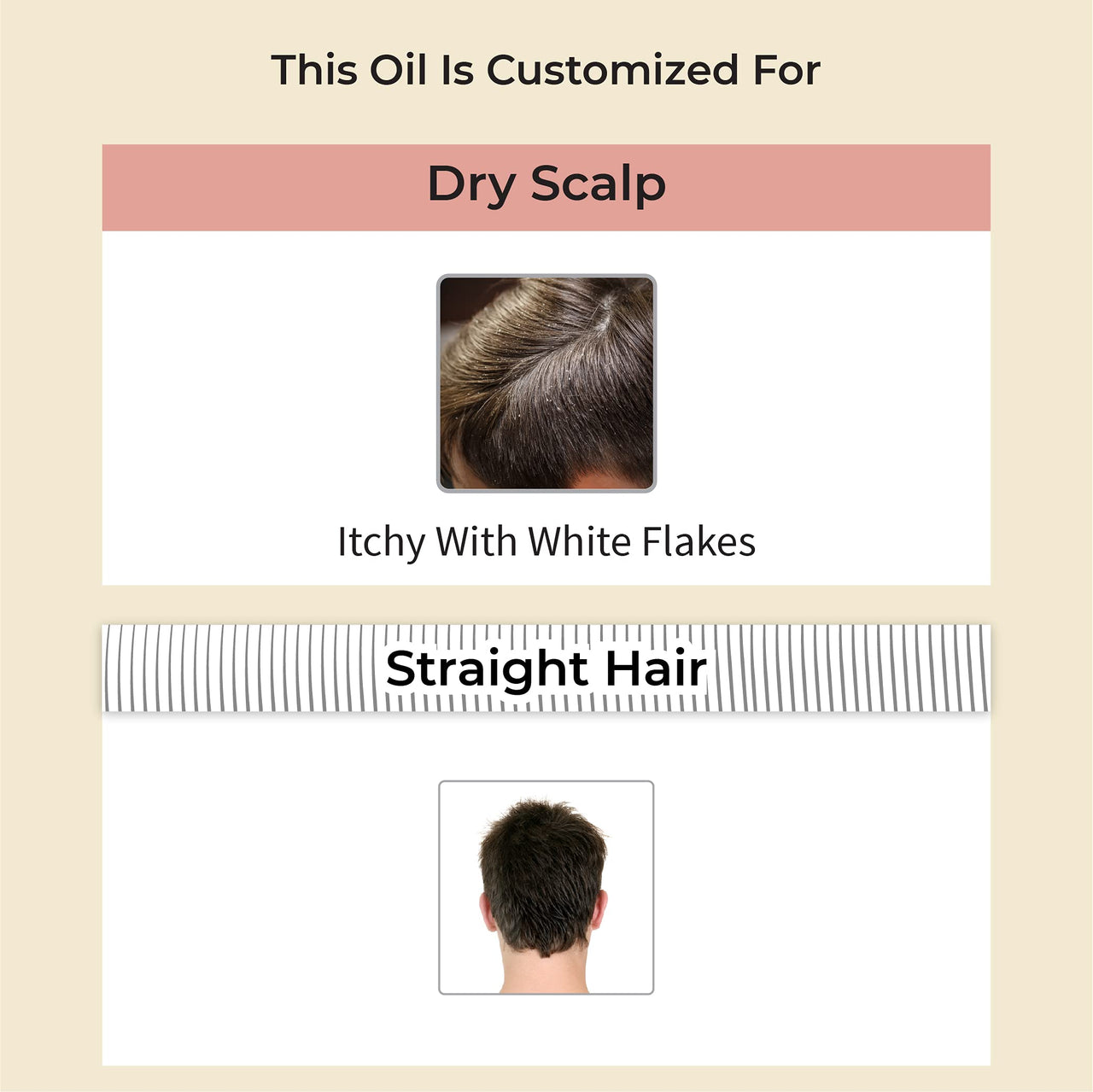 Vedix Customized Ayurvedic Mens Hair Oil for Hair Growth - Vedix Niryath Root Stimulating Hair Oil With Aloe Vera + Licorice + Amla Customized For Dry Scalp & Straight Hair - 100ml