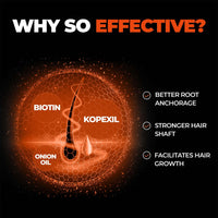 Beardo Hair Growth Vitalizer Shampoo, 200 ml | Shampoo for Men | Promotes Hair Growth | Sulphate and Paraben Free Shampoo | With Onion Oil & Biotin