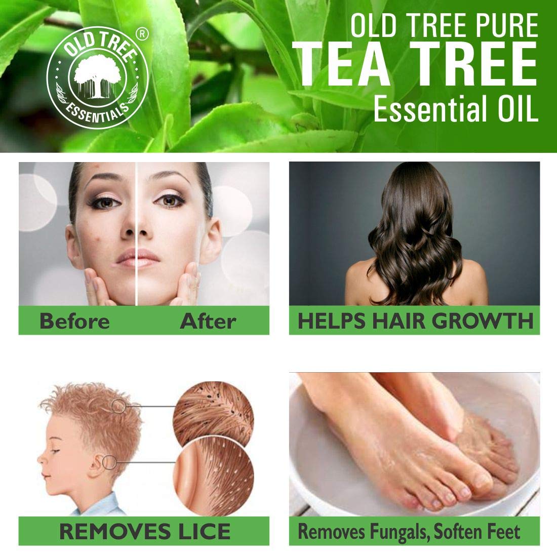 Old Tree Pure & Natural Tea Tree Essential Oil (15ml) - for Skin, Diffusers, Hair, Body, Acne, Nail care - Undiluted Essential Oil with Dropper for Aroma Therapy and Stress Relief