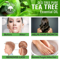 Old Tree Pure & Natural Tea Tree Essential Oil (15ml) - for Skin, Diffusers, Hair, Body, Acne, Nail care - Undiluted Essential Oil with Dropper for Aroma Therapy and Stress Relief
