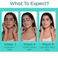 iVedic AyurScience Skin Brightening Serum for Women and Men (1% Hydrogen Aquaporin, 2% Squalene & Betaine 2%) Removes Tan For Even Skin Tone - Only Suitable for Dry Skin - 30 ml