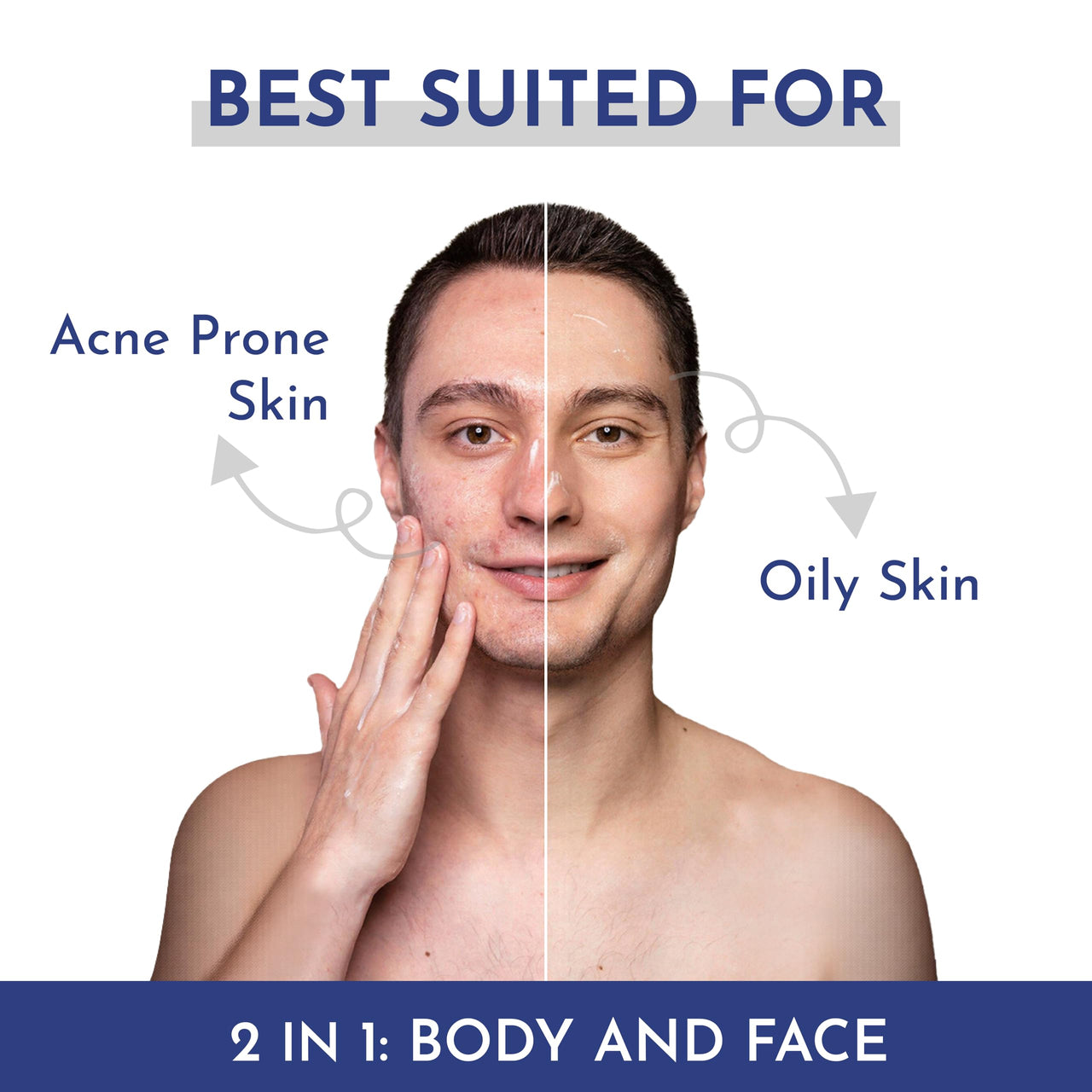 Mannlich Anti-Acne Soap | Controls Excess Sebum | Handmade Body & Face Soap for Acne-Prone and Oily Skin | 2% Salicylic Acid, 2% Niacinamide & 2% Tea Tree Oil | Brightens Skin, Fades Dark Spots | Prevents Body Acne | pH Balanced, SLS Free, Dermatologicall