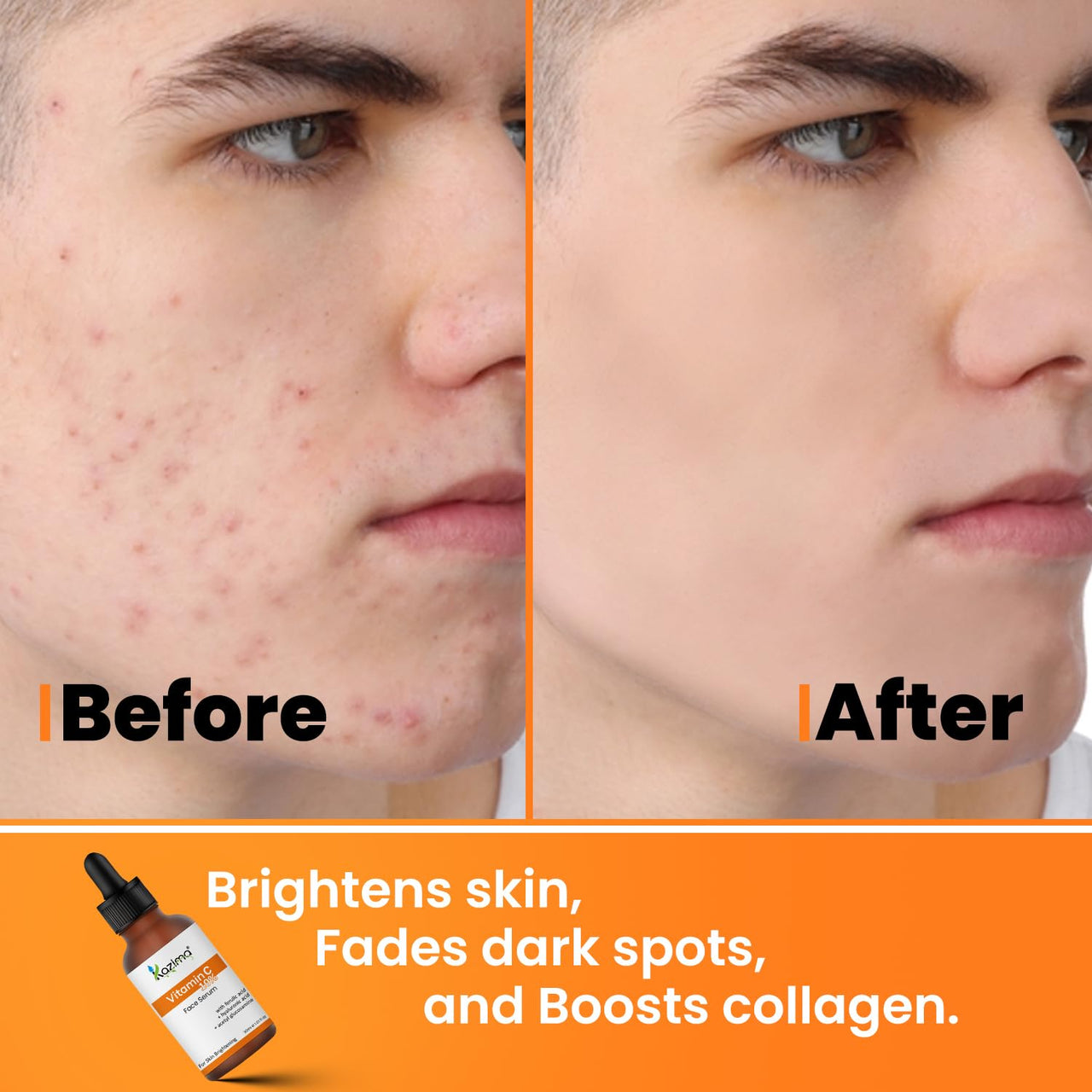 KAZIMA 10% Vitamin C Face Serum for Glowing Skin with 0.5% Ferulic Acid | Targets Dark Spot & Hyperpigmentation | For Dull Skin | Vitamin C Serum for Oily Skin | Suitable for Men & Women | 30 ml