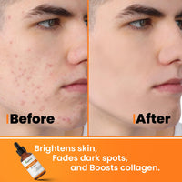 KAZIMA 10% Vitamin C Face Serum for Glowing Skin with 0.5% Ferulic Acid | Targets Dark Spot & Hyperpigmentation | For Dull Skin | Vitamin C Serum for Oily Skin | Suitable for Men & Women | 30 ml