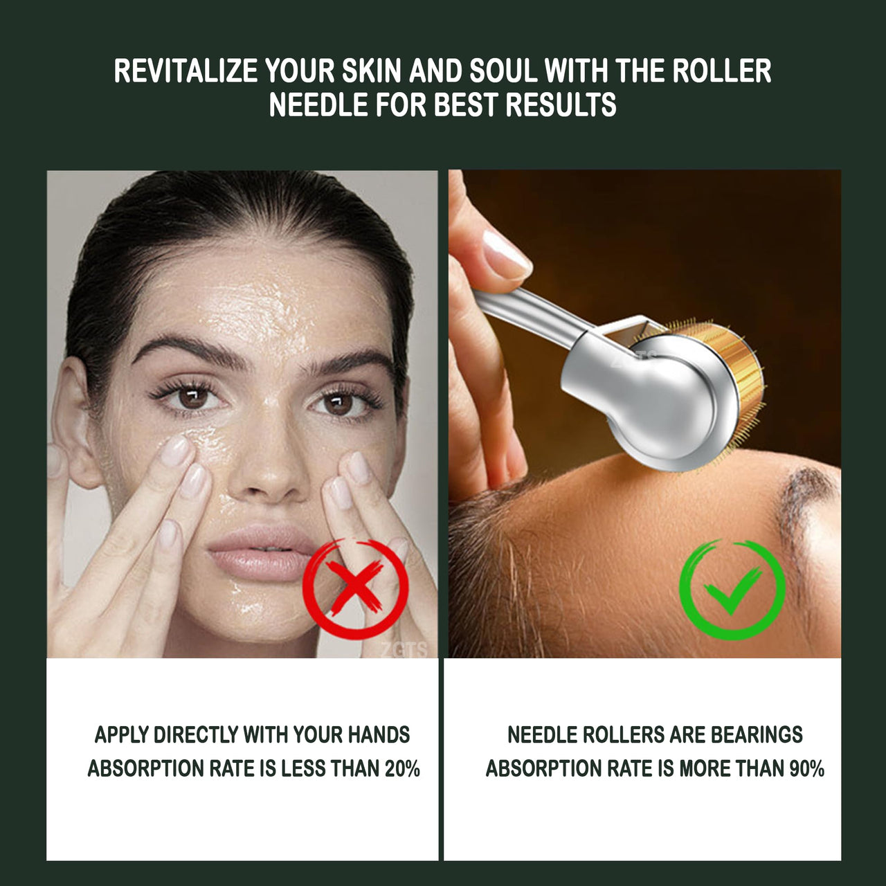 ZGTS Professional Gold Plated 192 Needles Titanium Alloy Derma Roller, Gold, 1.0 mm