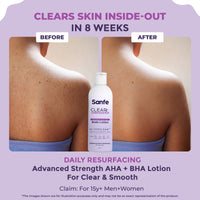 Sanfe Clear & Confident Glycolic Acid Body Lotion | Daily AHA Exfoliation for Rough & Bumpy Skin, Tan, Acne & Strawberry Skin | Niacinnamide, Lactic Acid SALICYLIC ACID 1% W/w | Smooth Skin from 1st Use | 200ml