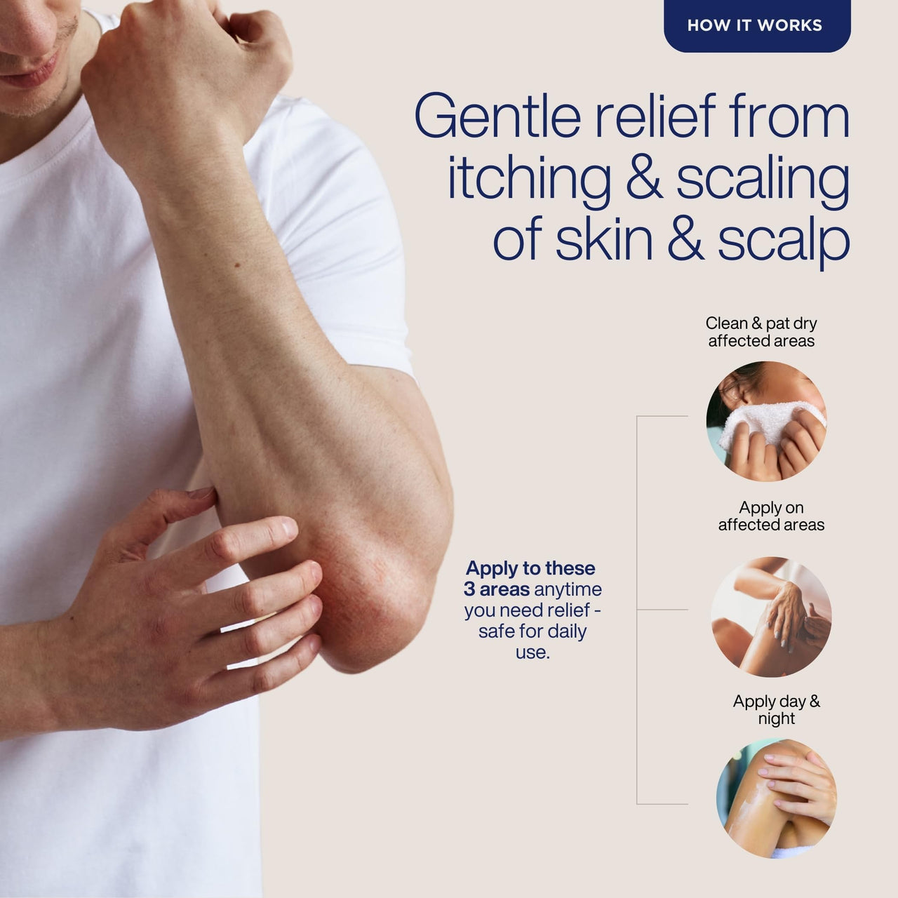 Puretive Psori Care Body & Scalp Oil | Relieves Itching & Redness | Fast-Absorbing | Non-Greasy| Helps Calm Eczema, Psoriasis, Dermatitis, Very Dry Skin, Ringworm, Fungal Infections, RashesI 100% Pure & Natural | 100ml