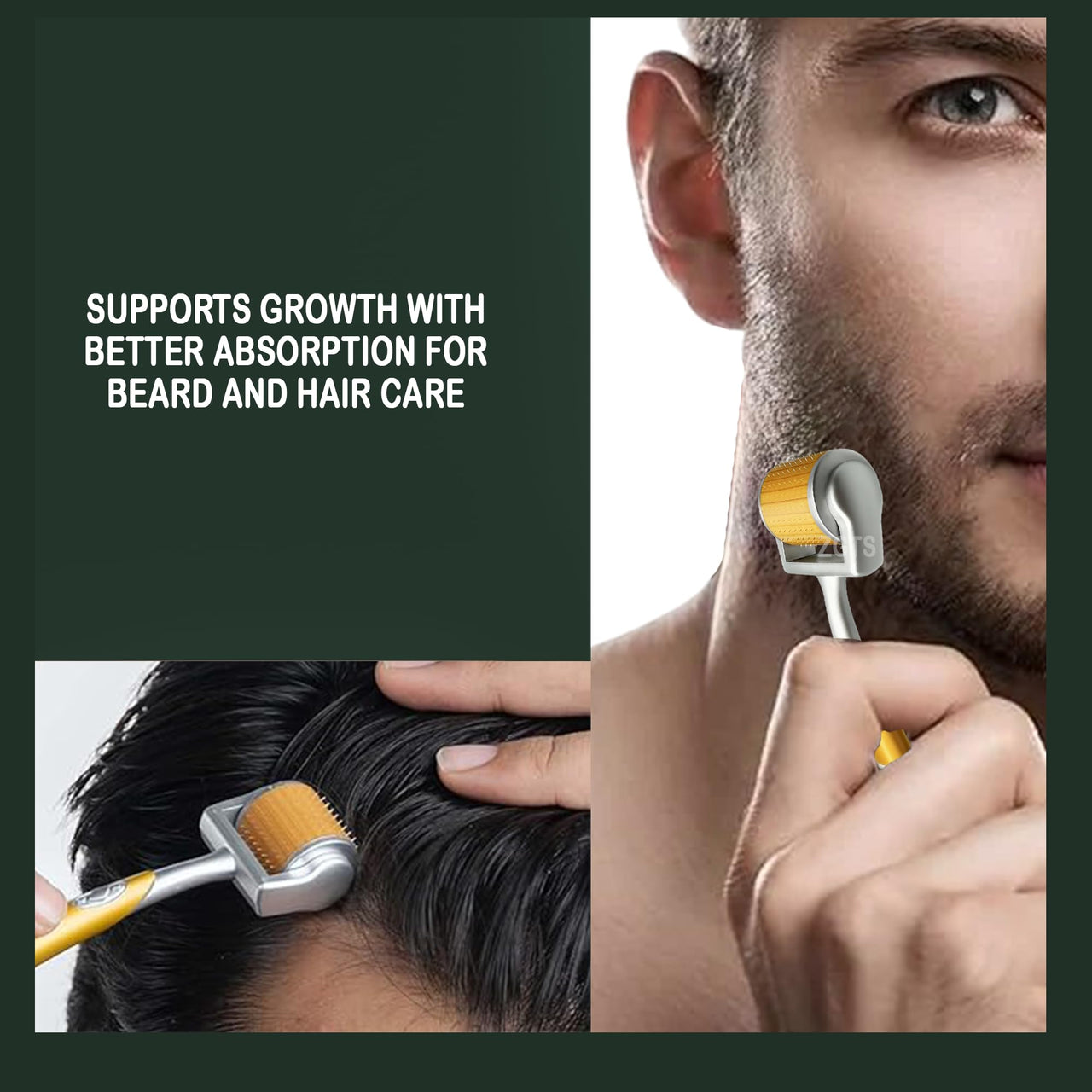 ZGTS Professional Gold Plated 192 Needles Titanium Alloy Derma Roller, Gold, 1.0 mm