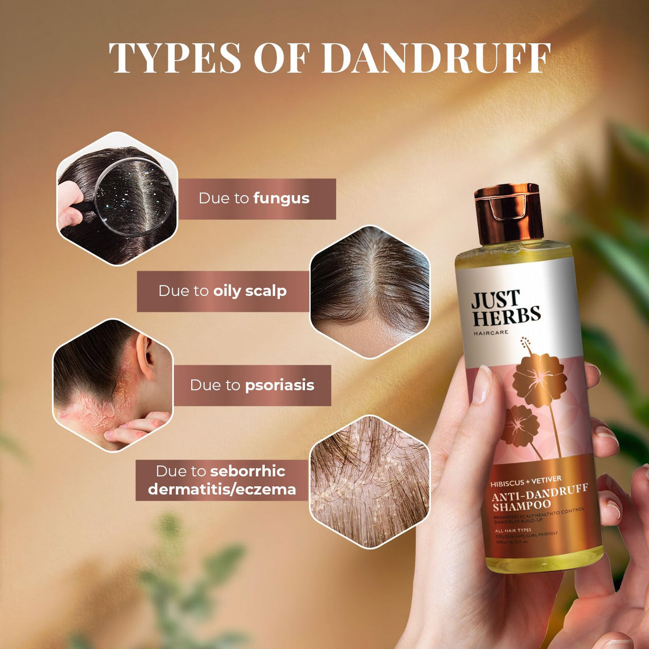 Just Herbs Ayurvedic Anti-Dandruff Shampoo For Strong & Bouncy Hair For Men & Women- Sls & Paraben Free- 200 ml