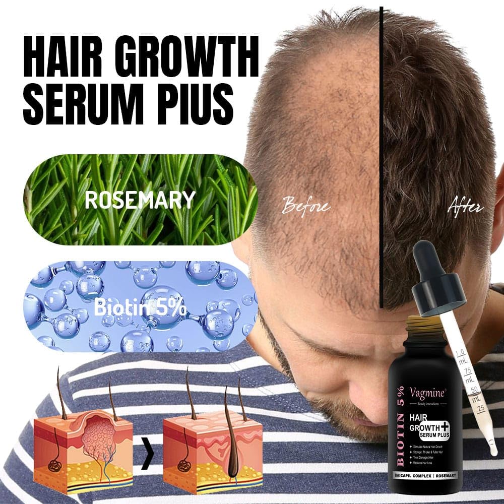 Vagmine Hair Growth Serum Plus With Biotin 5% & Rosemary - 60ml | Natural Treatment for Stronger, Thicker Hair | Promotes Healthy Hair Growth | Nourishes Scalp & Helps in Reduces Hair Fall
