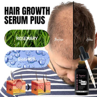 Vagmine Hair Growth Serum Plus With Biotin 5% & Rosemary - 60ml | Natural Treatment for Stronger, Thicker Hair | Promotes Healthy Hair Growth | Nourishes Scalp & Helps in Reduces Hair Fall
