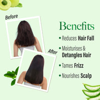 Kesh King Anti Hairfall Conditioner | Aloe Vera & 21 Herbs| No Paraben & No Silicon | 200 ml, 1 Count