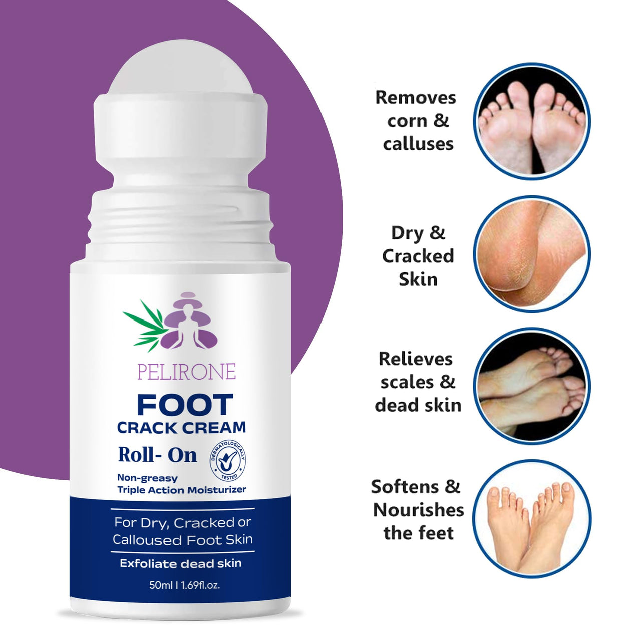 PELIRONE 20% Urea Foot Cream Roll On 50ml | For Dry & Cracked Heels | With 2% Lactic Acid, Olive Oil & Vitamin E | Helps Repair and Moisturise Cracked Heels 1