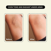 Bloom Brightening Underarm Roll - With AHA, Melazaro & Kojic Acid | Dark Underarms, Pigmentation & Odour| Rapid Melanin Reduction Formula | 0 White Cast | 50ml