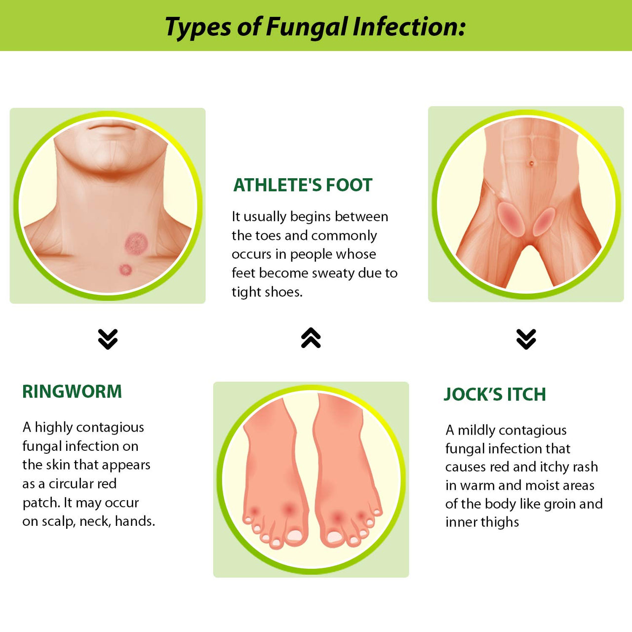 Tetmosol Anti-fungal Dusting Powder - for daily use - fights skin infections, prickly heat, itching - Pack of 3 (3x100gms)