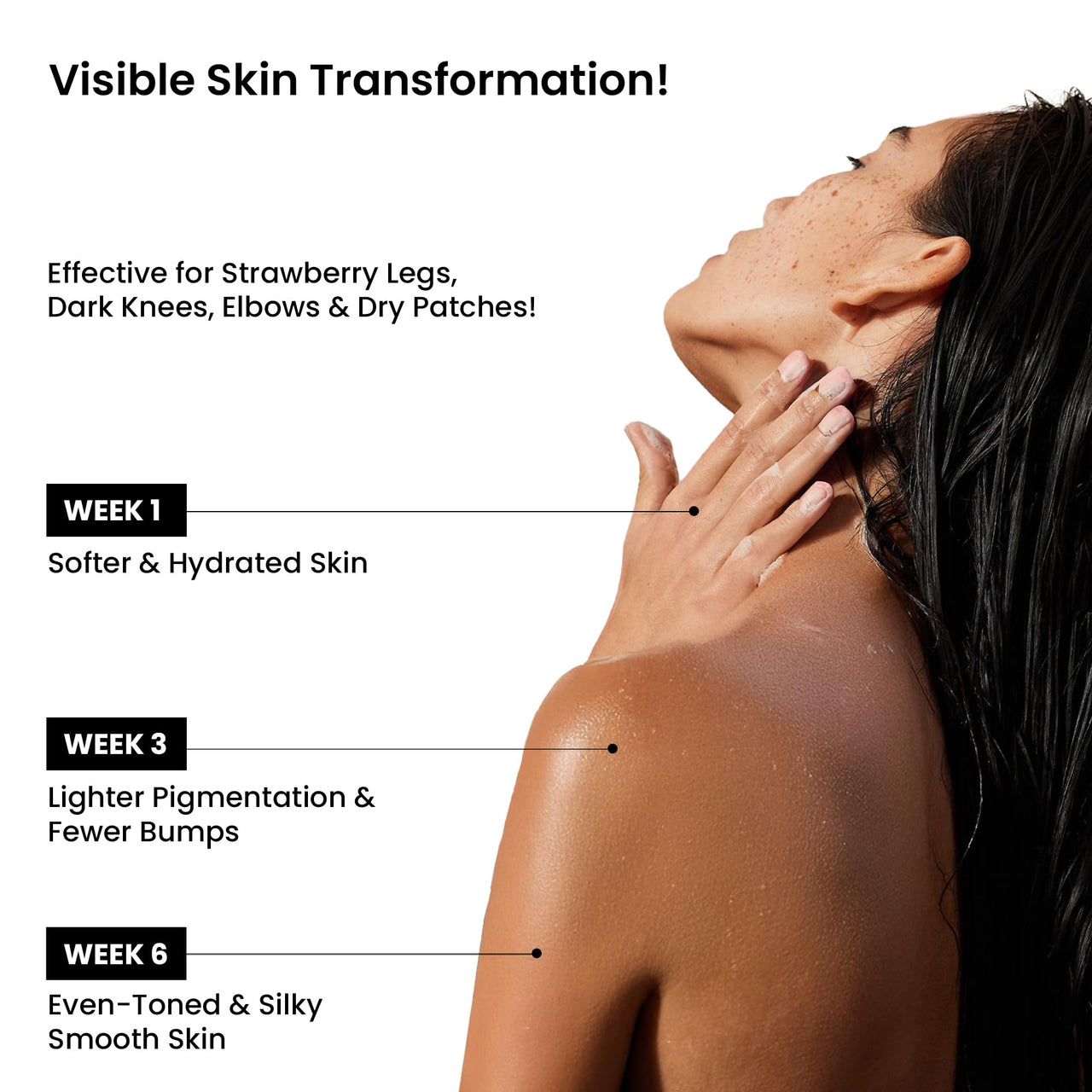 WildOak Watermelon Shea Sugar Body Scrub | 300gm | With Collagen & Peptides | Tan Removal | Lightens Dark Area Like Neck & Elbows | Smoothen Bumpy Legs & Hands | Ultra Hydrating & Exfoliating Scrub