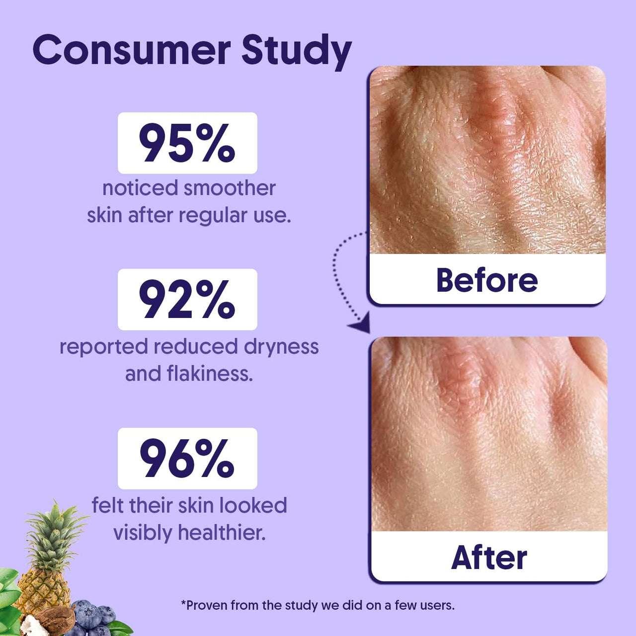 Aravi Organic 10% AHA + 1% BHA Body Lotion For Exfoliation - Treats Strawberry Legs & Bumpy Skin With Ceramide - Skin Britheninig Lotion With Niacinamide and Shea Butter - 200 ml