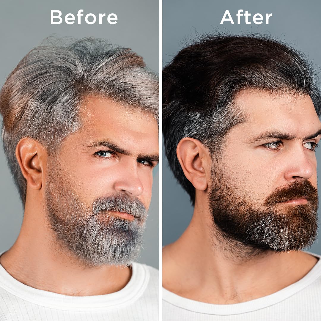 Orgatre Anti-Gray Hair Serum With Arcolys, Melanogray, Black Seed Oil & Hibiscus Extract | Light-Weight, Non-Sticky 50ml