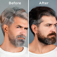 Orgatre Anti-Gray Hair Serum With Arcolys, Melanogray, Black Seed Oil & Hibiscus Extract | Light-Weight, Non-Sticky 50ml