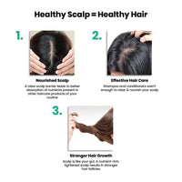 ThriveCo Scalp Vitalizing Serum | Tightens Scalp Skin, Combats Inflammation, Gives Hydration, Prevents Hair Breakage & Promotes Hair Growth & Strength | For Men & Women | Travel-Friendly (10 ml)