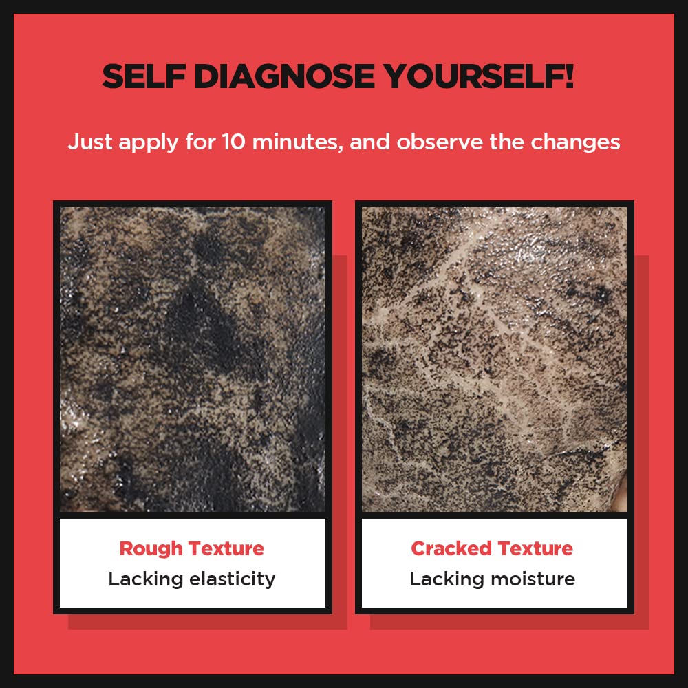 SKIN1004 Zombie Beauty Mummy Pack& Activator Kit, Wrinkles Treatment, Smoothening,Wrinkles, 140 Grams