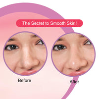 DR.Rashel Strawberry Nose Strips For Pore Cleansing | For Painless Blackheads Removal | Instant Blackhead Remover | 20 PCS