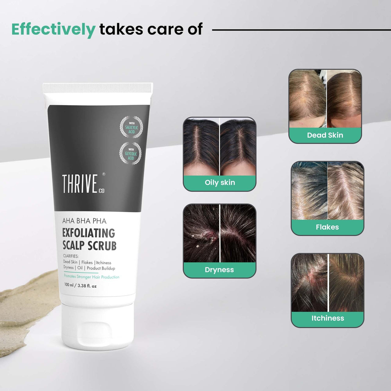 ThriveCo AHA BHA PHA Exfoliating Scalp Scrub | Clears Dandruff, Dead Skin, Oil & Product Buildup And Promotes Hair Growth | Acts On Dry, Flaky & Itchy Scalp | For Men & Women | 100ml